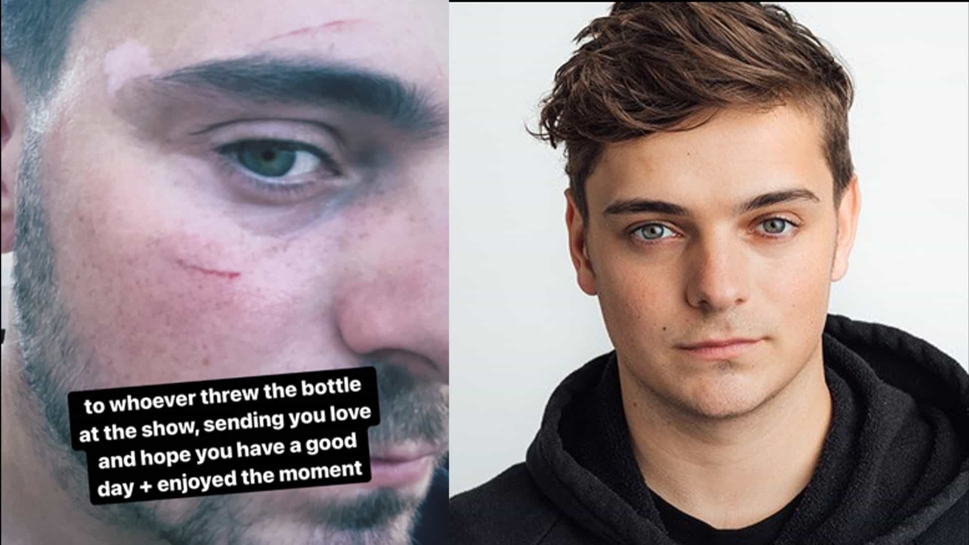 Martin Garrix gets hit by bottle at club show in Las Vegas